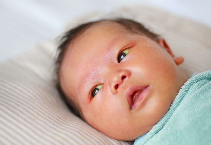 Newborn jaundice explained