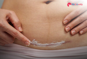 Postpartum Bleeding: What’s Normal & When to Worry