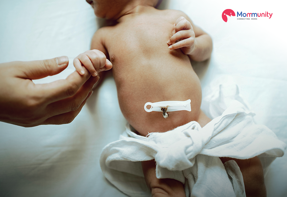 Still Unsure About Umbilical Cord Care? Avoid These Common Mistakes
