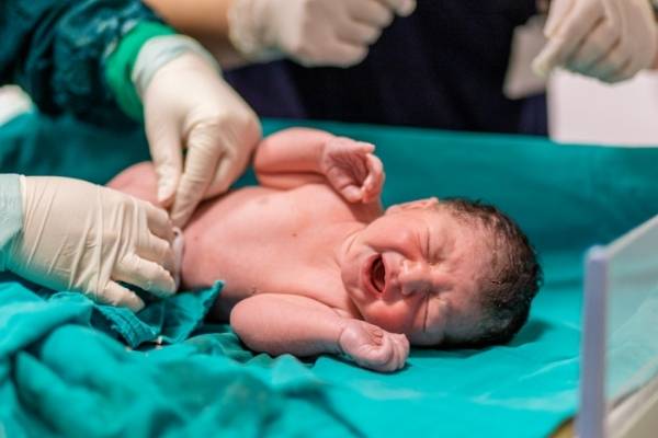 parents make mistakes with cord care with new born babies
