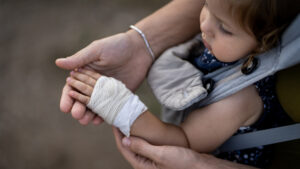 When a toddler injury needs urgent help When a toddler injury needs urgent help